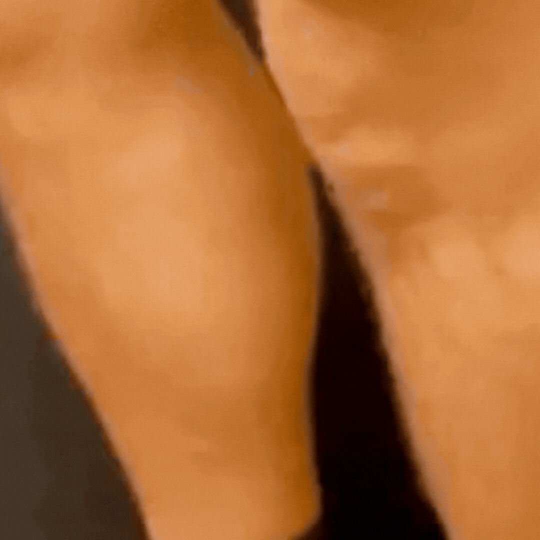 Venolyx™ | Magnesiumlotion