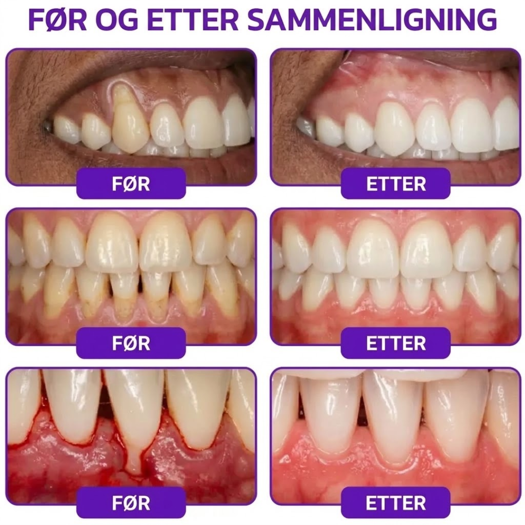 PerioCore™ | Bigift-tannkrem