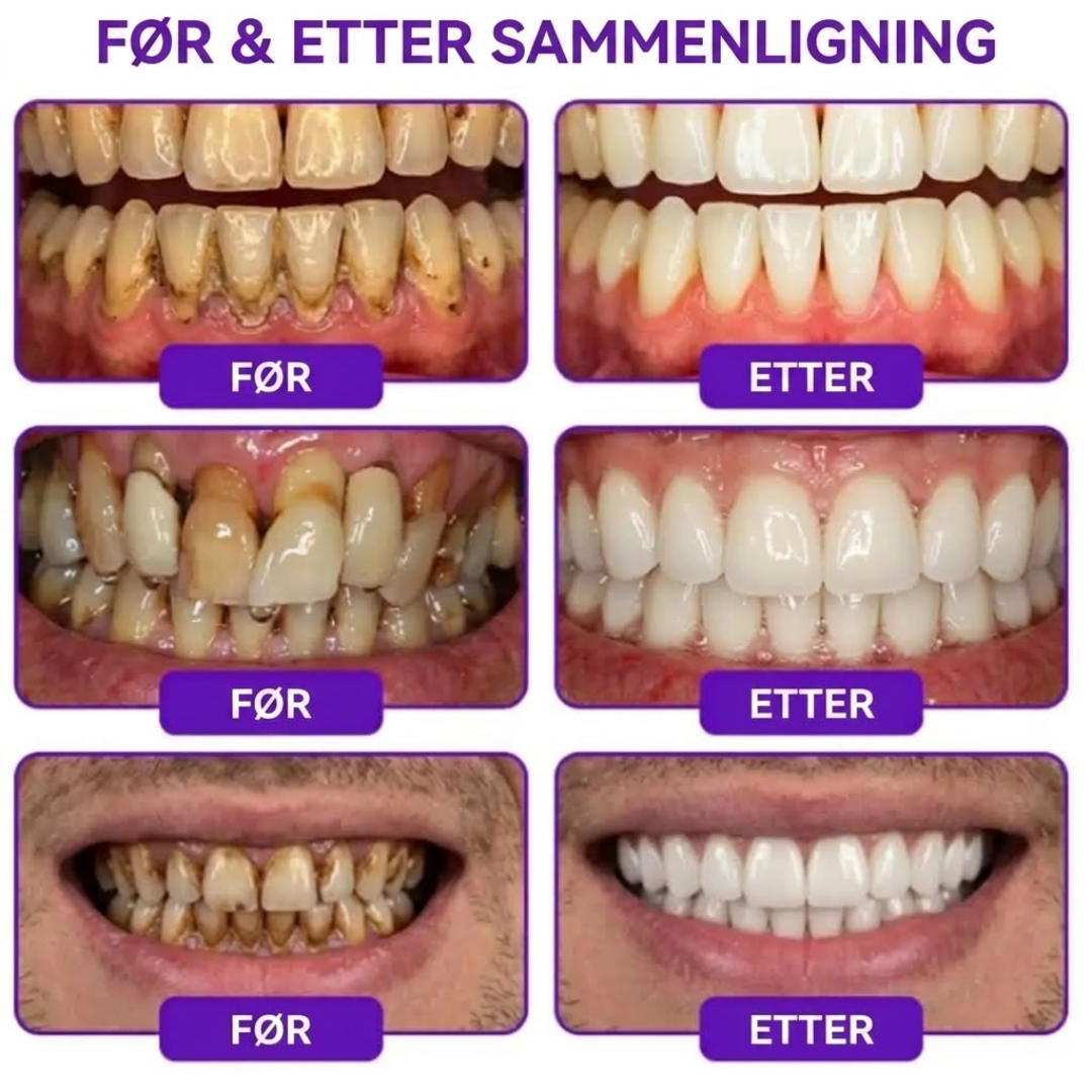 PerioCore™ | Bigift-tannkrem