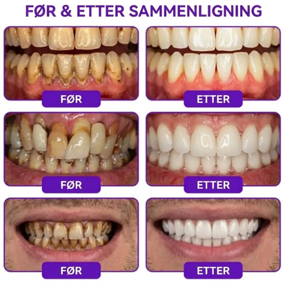 PerioCore™ | Bigift-tannkrem