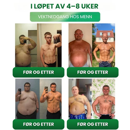 Slimora™ | Avansert mikronåleplaster for vektnedgang