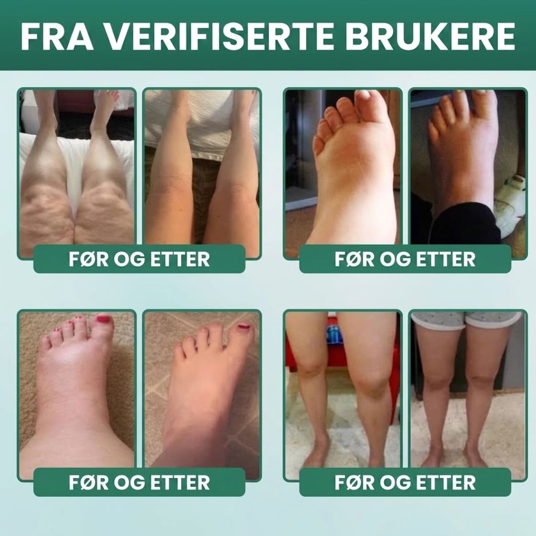 Lymphoria™ | Velværedråper for lymfedrenasje