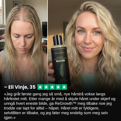 ReGrowth™ | Økologisk rosmarinsjampo for hårvekst
